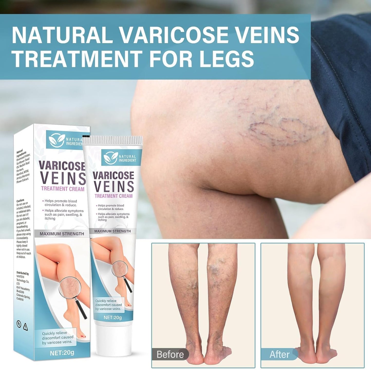 Varicose Vein Treatment for Legs, Varicose Vein Relief Cream, Improves Blood Circulation, Quickly Relieves Leg Pain